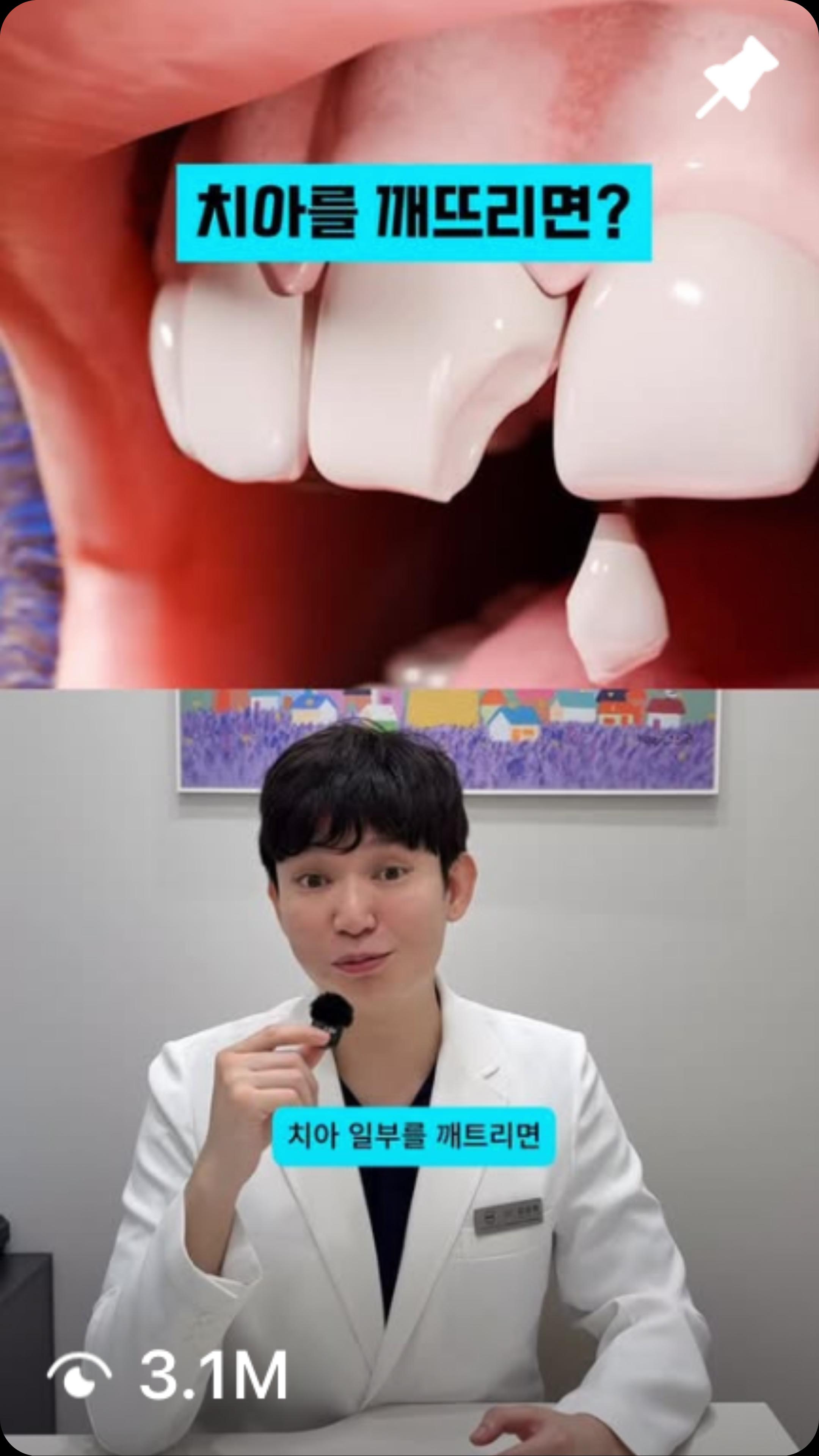 치아를 깨뜨리면?